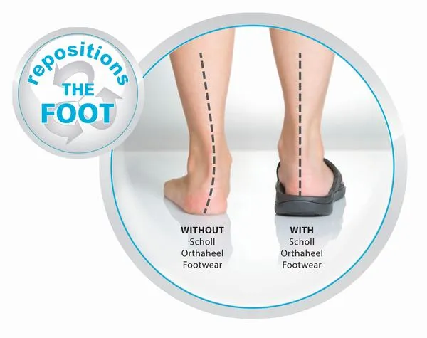 Scholl Orthaheel Fiji Womens Comfortable Rubber Thongs With Support Scholl Orthaheel Shoes